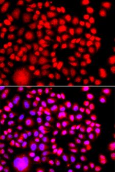 TESK2 Antibody - Immunofluorescence analysis of A549 cells using TESK2 Polyclonal Antibody.