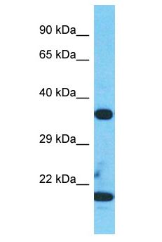 TESPA1 / KIAA0748 Antibody - TESPA1 / KIAA0748 antibody Western Blot of Jurkat. Antibody dilution: 1 ug/ml.  This image was taken for the unconjugated form of this product. Other forms have not been tested.