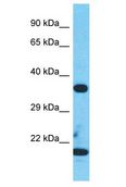 TESPA1 / KIAA0748 Antibody - TESPA1 / KIAA0748 antibody Western Blot of Jurkat. Antibody dilution: 1 ug/ml.  This image was taken for the unconjugated form of this product. Other forms have not been tested.