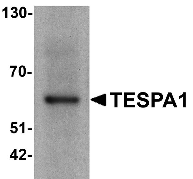 TESPA1 / KIAA0748 Antibody - Western blot analysis of TESPA1 in A431 cell lysate with TESPA1 antibody at 1 ug/ml.
