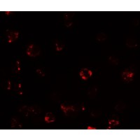 TESPA1 / KIAA0748 Antibody - Immunofluorescence of TESPA1 in A431 cells with TESPA1 antibody at 20 µg/mL.