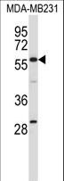 Testilin / EHD1 Antibody - EHD1 Antibody western blot of MDA-MB231 cell line lysates (35 ug/lane). The EHD1 antibody detected the EHD1 protein (arrow).