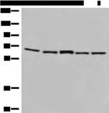 Testilin / EHD1 Antibody - Western blot analysis of TM4 and 231 cell Mouse brain tissue Hela and HT-29 cell lysates  using EHD1 Polyclonal Antibody at dilution of 1:500
