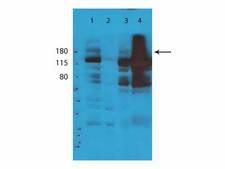 TET2 Antibody - Western Blot of rabbit Anti-Tet2 Antibody. Lane 1: Whole Cell Extract. Lane 2: Cytosolic Extract. Lane 3: Nuclear Extract. Lane 4: Chromatin Fraction. Load: 35 µg per lane. Primary antibody: TET2 antibody at 1:5000 for 5 hours at room temperature. Secondary antibody: HRP rabbit secondary antibody at 1:10,000 for 45 min at RT. Block: 5% BLOTTO overnight at 4°C. Predicted/Observed size: ~230 and ~150kDa. Other band(s): nonspecific.