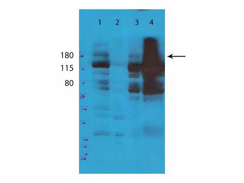 TET2 Antibody - Western Blot of rabbit Anti-Tet2 Antibody. Lane 1: Whole Cell Extract. Lane 2: Cytosolic Extract. Lane 3: Nuclear Extract. Lane 4: Chromatin Fraction. Load: 35 µg per lane. Primary antibody: TET2 antibody at 1:5000 for 5 hours at room temperature. Secondary antibody: HRP rabbit secondary antibody at 1:10,000 for 45 min at RT. Block: 5% BLOTTO overnight at 4°C. Predicted/Observed size: ~230 and ~150kDa. Other band(s): nonspecific.