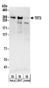 TET2 Antibody - Detection of Human TET2 by Western Blot. Samples: Whole cell lysate (50 ug) from HeLa, 293T, and Jurkat cells. Antibodies: Affinity purified rabbit anti-TET2 antibody used for WB at 0.1 ug/ml. Detection: Chemiluminescence with an exposure time of 30 seconds.