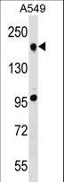 TET2 Antibody - TET2 Antibody western blot of A549 cell line lysates (35 ug/lane). The TET2 antibody detected the TET2 protein (arrow).
