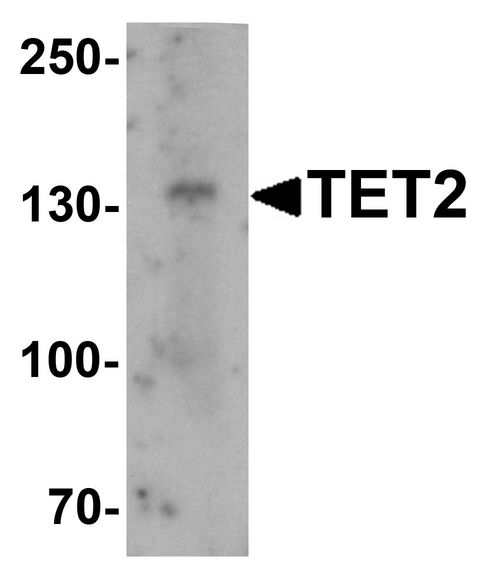 TET2 Antibody - Western blot analysis of TET2 in SK-N-SH cell lysate with TET2 antibody at 1 ug/ml.