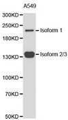 TET2 Antibody - Western blot analysis of extracts of A549 cell line, using TET2 antibody.
