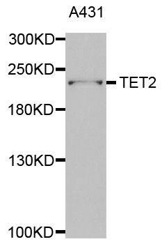 TET2 Antibody - Western blot analysis of extracts of A431 cells.