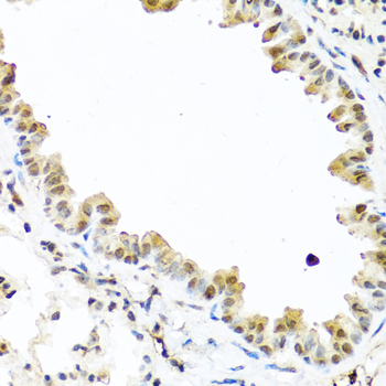 TET2 Antibody - Immunohistochemistry of paraffin-embedded mouse lung tissue.