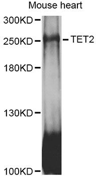 TET2 Antibody - Western blot analysis of extracts of mouse heart, using TET2 antibody at 1:1000 dilution. The secondary antibody used was an HRP Goat Anti-Rabbit IgG (H+L) at 1:10000 dilution. Lysates were loaded 25ug per lane and 3% nonfat dry milk in TBST was used for blocking. An ECL Kit was used for detection and the exposure time was 10s.