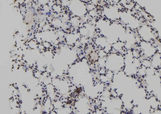 TET2 Antibody - 1:100 staining mouse lung tissue by IHC-P. The sample was formaldehyde fixed and a heat mediated antigen retrieval step in citrate buffer was performed. The sample was then blocked and incubated with the antibody for 1.5 hours at 22°C. An HRP conjugated goat anti-rabbit antibody was used as the secondary.