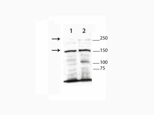 TET3 Antibody - Western Blot of rabbit Anti-TET3 Antibody. Lane 1: CEM nuclear extract. Lane 2: THP-1 nuclear extract. Load: 25 µg per lane. Primary antibody: TET3 antibody at 1:1000 for overnight at 4°C. Secondary antibody: HRP rabbit secondary antibody at 1:5000 for 45 min at RT. Block: 5% BLOTTO overnight at 4°C. Predicted/Observed size: Isoforms of TET3 include 180kDa, 167kDa and 78kDa. Other band(s): nonspecific.