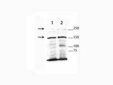 TET3 Antibody - Western Blot of rabbit Anti-TET3 Antibody. Lane 1: CEM nuclear extract. Lane 2: THP-1 nuclear extract. Load: 25 µg per lane. Primary antibody: TET3 antibody at 1:1000 for overnight at 4°C. Secondary antibody: HRP rabbit secondary antibody at 1:5000 for 45 min at RT. Block: 5% BLOTTO overnight at 4°C. Predicted/Observed size: Isoforms of TET3 include 180kDa, 167kDa and 78kDa. Other band(s): nonspecific.