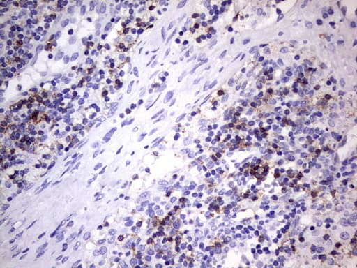 TET3 Antibody - IHC of paraffin-embedded Human lymph node tissue using anti-TET3 mouse monoclonal antibody. (Heat-induced epitope retrieval by 1 mM EDTA in 10mM Tris, pH8.5, 120°C for 3min).