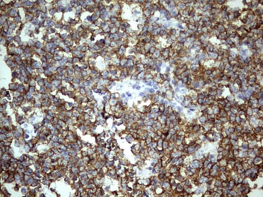 TET3 Antibody - IHC of paraffin-embedded Human tonsil using anti-TET3 mouse monoclonal antibody. (Heat-induced epitope retrieval by 1 mM EDTA in 10mM Tris, pH8.5, 120°C for 3min).