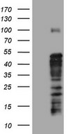 TET3 Antibody - Human recombinant protein fragment corresponding to amino acids 241-568 of human TET3 (NP_659430) produced in E.coli.