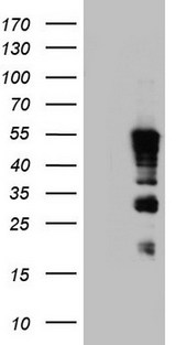 TET3 Antibody - HEK293T cells were transfected with the pCMV6-ENTRY control (Left lane) or pCMV6-ENTRY TET3 (Right lane) cDNA for 48 hrs and lysed. Equivalent amounts of cell lysates (5 ug per lane) were separated by SDS-PAGE and immunoblotted with anti-TET3.