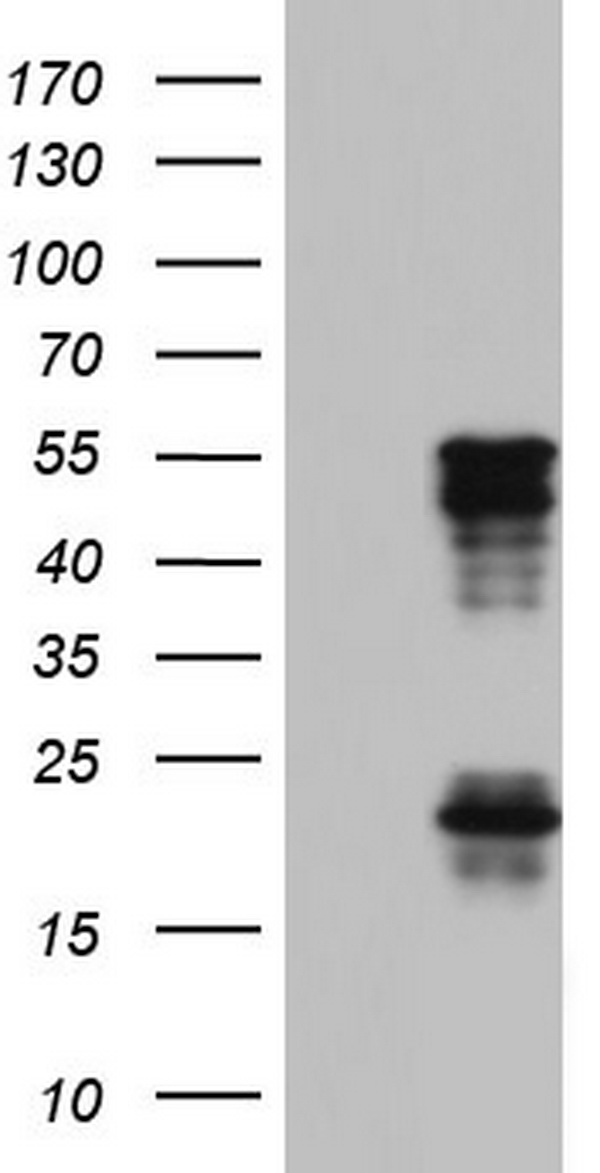 TET3 Antibody - HEK293T cells were transfected with the pCMV6-ENTRY control (Left lane) or pCMV6-ENTRY TET3 (Right lane) cDNA for 48 hrs and lysed. Equivalent amounts of cell lysates (5 ug per lane) were separated by SDS-PAGE and immunoblotted with anti-TET3.
