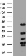 TET3 Antibody - Human recombinant protein fragment corresponding to amino acids 241-568 of human TET3 (NP_659430) produced in E.coli.