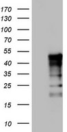 TET3 Antibody - Human recombinant protein fragment corresponding to amino acids 241-568 of human TET3 (NP_659430) produced in E.coli.