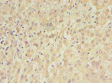 TET3 Antibody - Immunohistochemistry of paraffin-embedded human liver tissue using antibody at 1:100 dilution.  This image was taken for the unconjugated form of this product. Other forms have not been tested.
