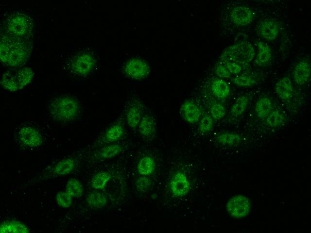 TET3 Antibody - Immunofluorescence staining of TET3 in MCF7 cells. Cells were fixed with 4% PFA, permeabilzed with 0.1% Triton X-100 in PBS, blocked with 10% serum, and incubated with rabbit anti-Human TET3 polyclonal antibody (dilution ratio 1:200) at 4°C overnight. Then cells were stained with the Alexa Fluor 488-conjugated Goat Anti-rabbit IgG secondary antibody (green). Positive staining was localized to Nucleus.