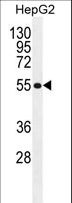 TETRAN / MFSD10 Antibody - MFS10 Antibody western blot of HepG2 cell line lysates (35 ug/lane). The MFS10 antibody detected the MFS10 protein (arrow).