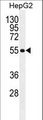 TETRAN / MFSD10 Antibody - MFS10 Antibody western blot of HepG2 cell line lysates (35 ug/lane). The MFS10 antibody detected the MFS10 protein (arrow).
