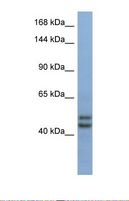 TEX10 Antibody - Western blot of Human Fetal Brain. TEX10 antibody dilution 1.0 ug/ml.  This image was taken for the unconjugated form of this product. Other forms have not been tested.