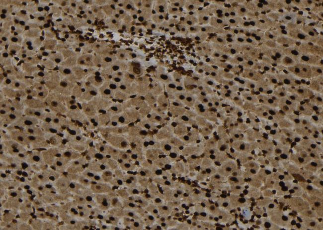 TEX10 Antibody - 1:100 staining mouse liver tissue by IHC-P. The sample was formaldehyde fixed and a heat mediated antigen retrieval step in citrate buffer was performed. The sample was then blocked and incubated with the antibody for 1.5 hours at 22°C. An HRP conjugated goat anti-rabbit antibody was used as the secondary.