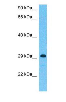 TEX101 Antibody - Western blot of TEX101 Antibody with human Jurkat Whole Cell lysate.  This image was taken for the unconjugated form of this product. Other forms have not been tested.