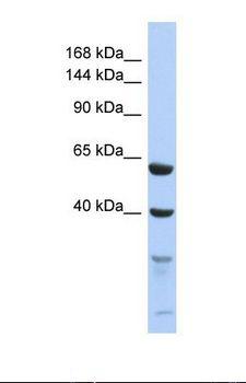 TEX11 Antibody - Western blot of Human 293T . TEX11 antibody dilution 1.0 ug/ml.  This image was taken for the unconjugated form of this product. Other forms have not been tested.