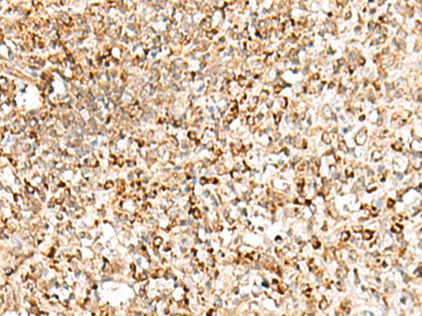 TEX11 Antibody - Immunohistochemistry of paraffin-embedded Human tonsil tissue  using TEX11 Polyclonal Antibody at dilution of 1:50(×200)