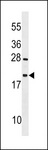 TEX12 Antibody - TEX12 Antibody western blot of mouse heart tissue lysates (35 ug/lane). The TEX12 antibody detected the TEX12 protein (arrow).
