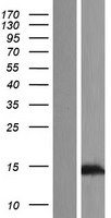 TEX12 Protein - Western validation with an anti-DDK antibody * L: Control HEK293 lysate R: Over-expression lysate