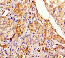 TEX13A Antibody - Immunohistochemistry of paraffin-embedded human testis tissue using TEX13A Antibody at dilution of 1:100