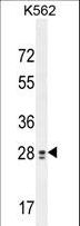 TEX13B Antibody - TEX13B Antibody western blot of K562 cell line lysates (35 ug/lane). The TEX13B antibody detected the TEX13B protein (arrow).
