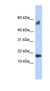TEX19 Antibody - TEX19 antibody Western blot of Placenta lysate. This image was taken for the unconjugated form of this product. Other forms have not been tested.