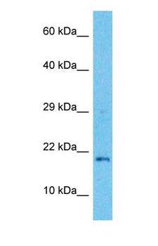 TEX19 Antibody - Western blot of TEX19 Antibody with human Stomach Tumor lysate.  This image was taken for the unconjugated form of this product. Other forms have not been tested.