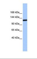 TEX2 Antibody - Jurkat cell lysate. Antibody concentration: 0.5 ug/ml. Gel concentration: 6%-18%.  This image was taken for the unconjugated form of this product. Other forms have not been tested.