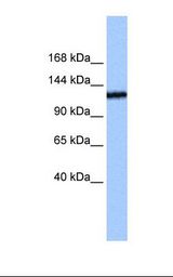 TEX2 Antibody - Jurkat cell lysate. Antibody concentration: 0.5 ug/ml. Gel concentration: 6%-18%.  This image was taken for the unconjugated form of this product. Other forms have not been tested.