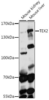 TEX2 Antibody - Western blot analysis of extracts of various cell lines, using TEX2 antibody at 1:1000 dilution. The secondary antibody used was an HRP Goat Anti-Rabbit IgG (H+L) at 1:10000 dilution. Lysates were loaded 25ug per lane and 3% nonfat dry milk in TBST was used for blocking. An ECL Kit was used for detection and the exposure time was 90s.