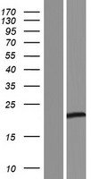 TEX22 Protein - Western validation with an anti-DDK antibody * L: Control HEK293 lysate R: Over-expression lysate