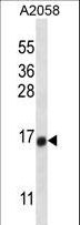 TEX261 Antibody - TEX261 Antibody western blot of A2058 cell line lysates (35 ug/lane). The TEX261 antibody detected the TEX261 protein (arrow).