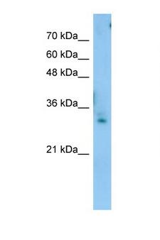 TEX264 Antibody - TEX264 antibody Western blot of Jurkat Cell lysate. Antibody concentration 1 ug/ml. This image was taken for the unconjugated form of this product. Other forms have not been tested.