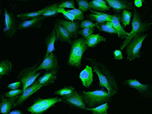 TEX264 Antibody - Immunofluorescence staining of TEX264 in U251MG cells. Cells were fixed with 4% PFA, permeabilzed with 0.1% Triton X-100 in PBS, blocked with 10% serum, and incubated with rabbit anti-Human TEX264 polyclonal antibody (dilution ratio 1:200) at 4°C overnight. Then cells were stained with the Alexa Fluor 488-conjugated Goat Anti-rabbit IgG secondary antibody (green) and counterstained with DAPI (blue). Positive staining was localized to Cytoplasm.