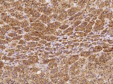 TEX264 Antibody - Immunochemical staining of human TEX264 in human adrenal gland with rabbit polyclonal antibody at 1:5000 dilution, formalin-fixed paraffin embedded sections.
