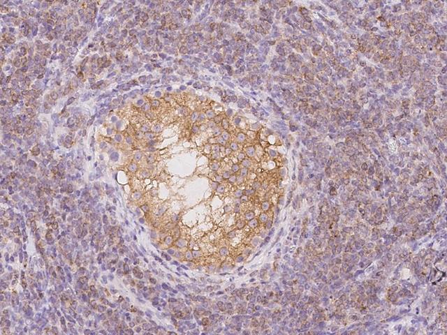 TEX264 Antibody - Immunochemical staining of human TEX264 in human testis with rabbit polyclonal antibody at 1:5000 dilution, formalin-fixed paraffin embedded sections.